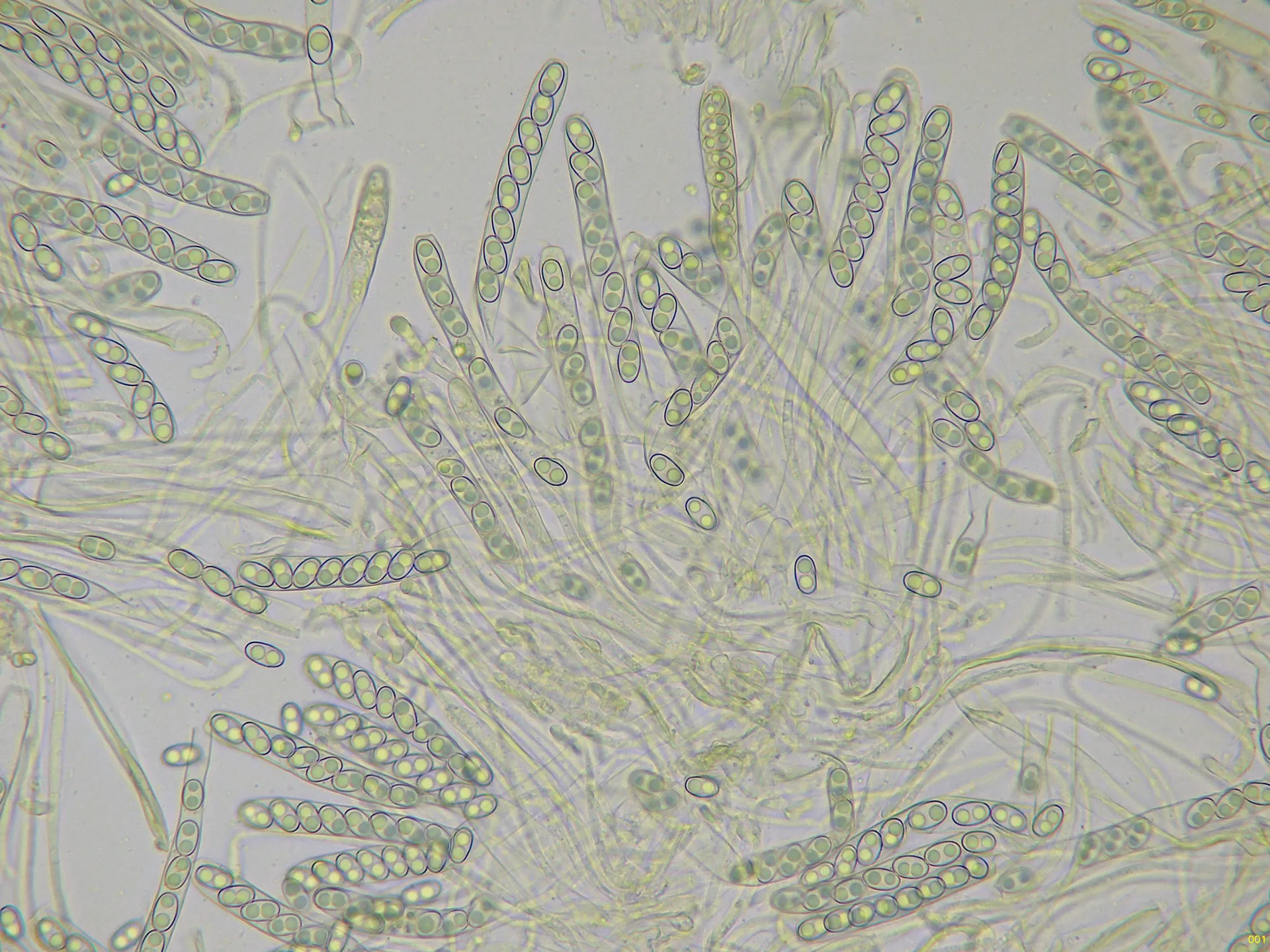 Microscopía de Otidea tuomikoskii - 10 - Ascos x 400-001